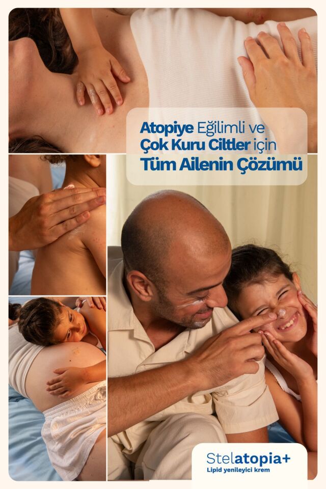 Stelatopia Lipit Yenileyici Atopik Cilt Ve Çok Kuru Cilt Için Rahatlatıcı Krem 300ml