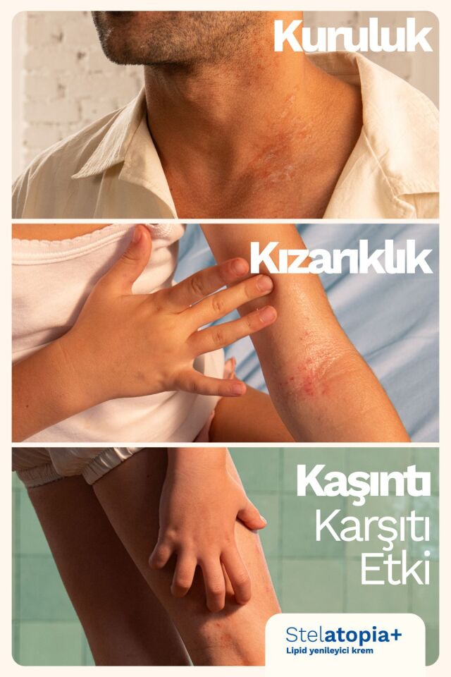Stelatopia Lipit Yenileyici Atopik Cilt Ve Çok Kuru Cilt Için Rahatlatıcı Krem 300ml