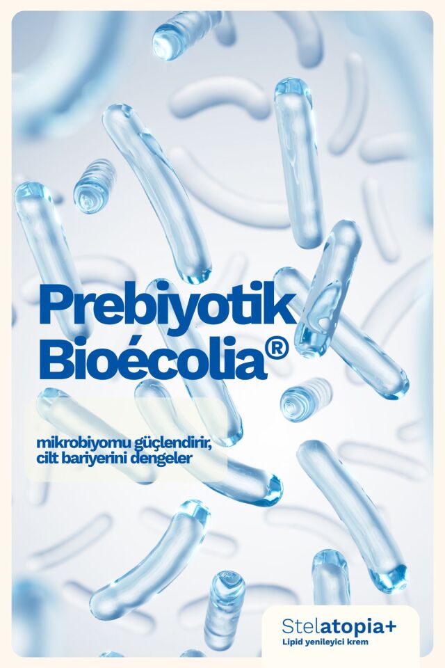 Stelatopia Lipit Yenileyici Atopik Cilt Ve Çok Kuru Cilt Için Rahatlatıcı Krem 300ml