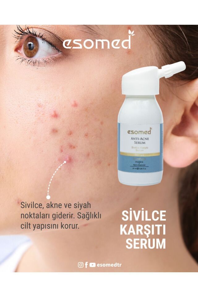 Sivilce, Akne, Siyah Nokta Önleyici Ve Tedavi Edici Bakım Serumu 10ml