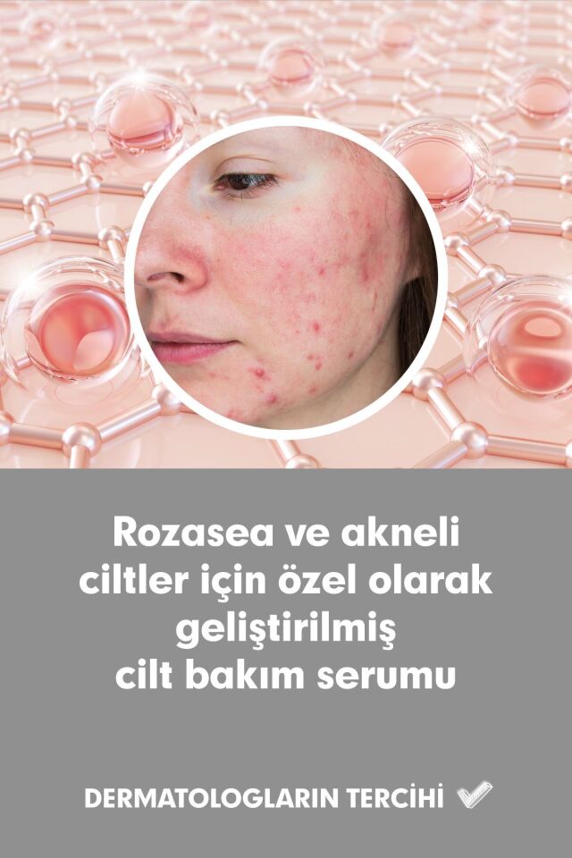 Clinic Rose Serum 50ml - Jumbo Boy