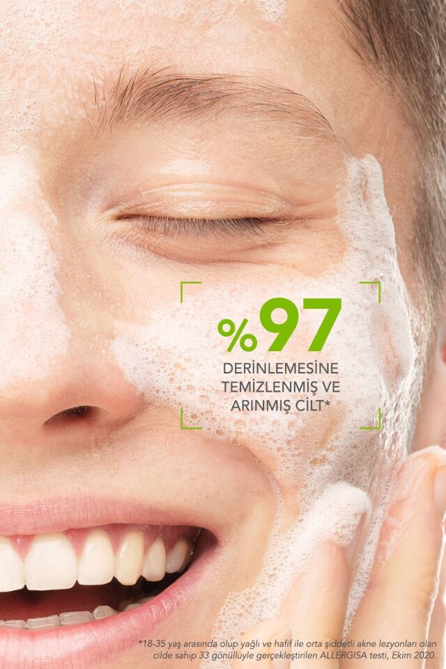 Sebium Yağlı, Akne Eğilimli Cilt Sivilce Karşıtı Salisilik Asit Glikolik Asit Temizleme Jeli 200 ml
